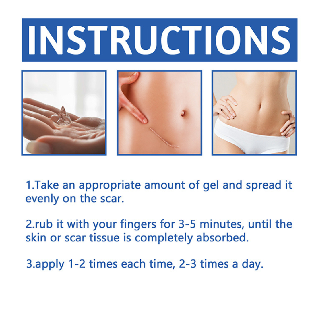 Scar removal cream treatment